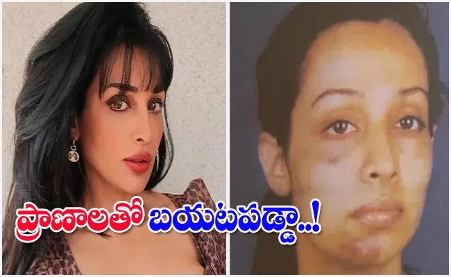 Flora Saini Alleged Famous Producer Hit On My Private Parts - Sakshi