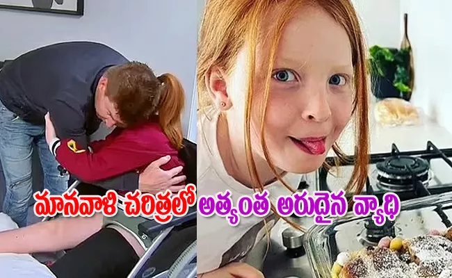 Australia 10 Years Infected Rarest Painful Disease Of The World - Sakshi