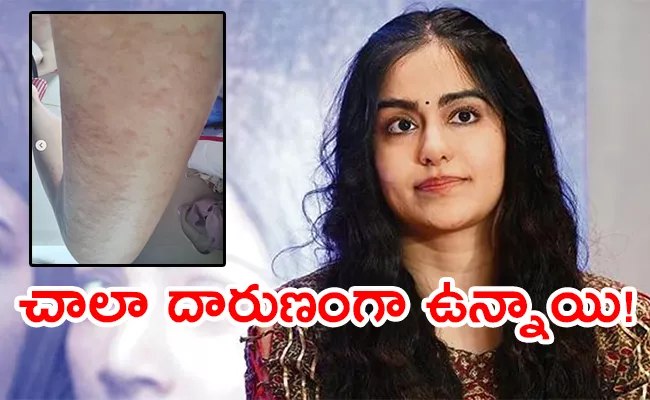 Adah Sharma Shares Her Health Condition With Fans Goes Viral - Sakshi