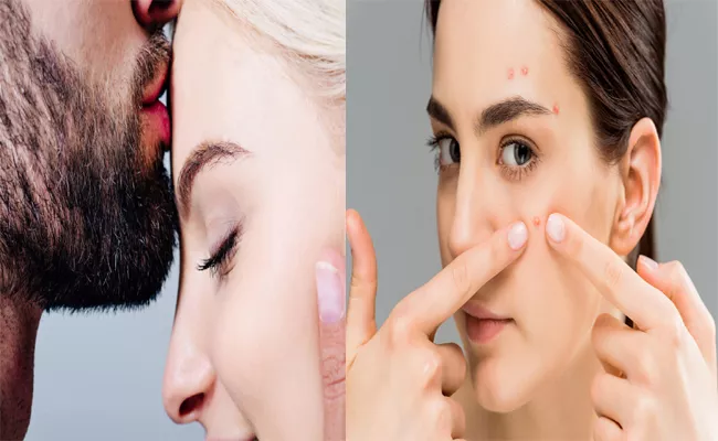 How Kissing And Touching Skin Causes  - Sakshi