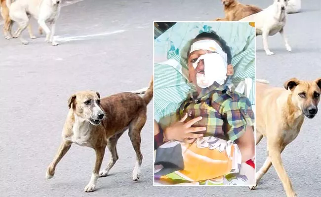 Hyderabad Dog Attack 4year old Boy  
