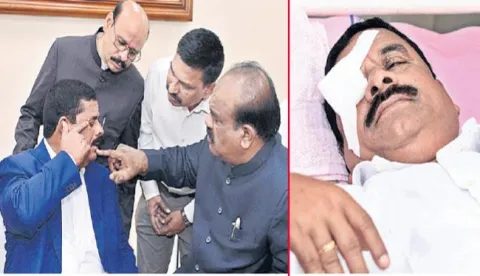 Telangana Legislative Council Chairman Swamy Goud cornea is Damaged - Sakshi