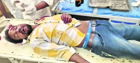 అనారో