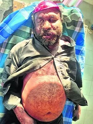 రోడ్డ