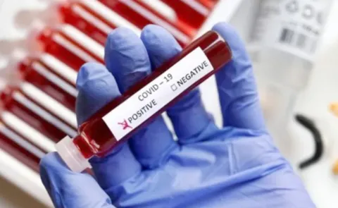 Corona Case Registered In Hyderabad