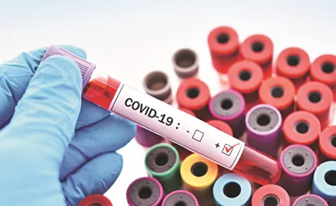 Most Covid Cases in India Mild Under Home Care