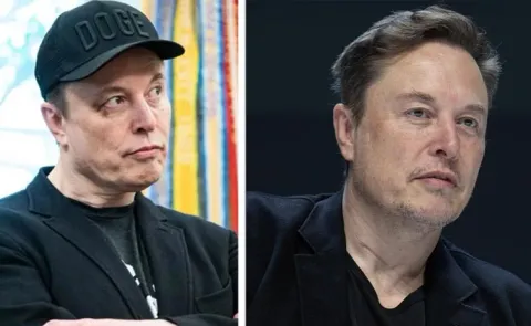 Elon Musk Black Eye Mystery12