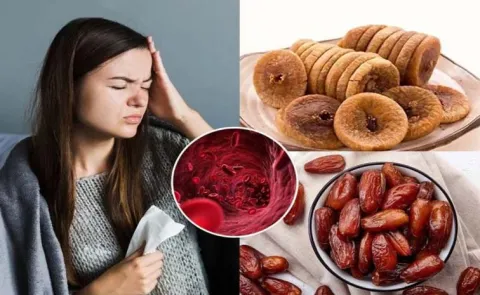 Anemia In Females : Symptoms Causes And Treatment