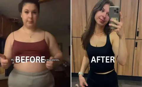 Weight Loss Story : Nurse Becomes Unrecognisable After Losing 44 kg Weight12