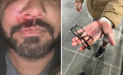 Indian Origin Unprovoked Racist Attack by Teenagers