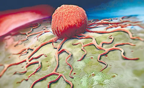 The different attitudes seen in cancer cases across the country