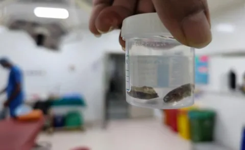 Hyderabad Woman Swallows Karakkaya in Sleep