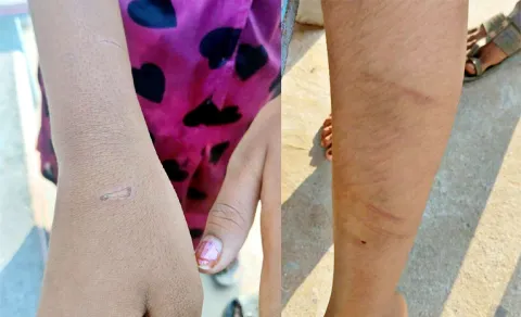 9th grade student incident