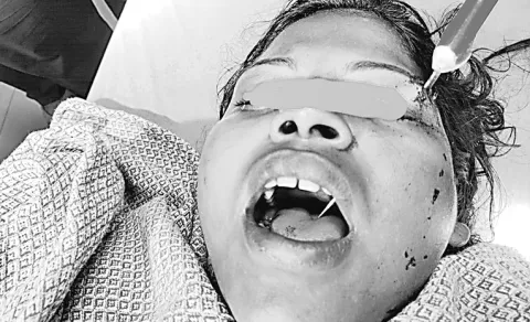 Rare surgery at Kakinada GGH