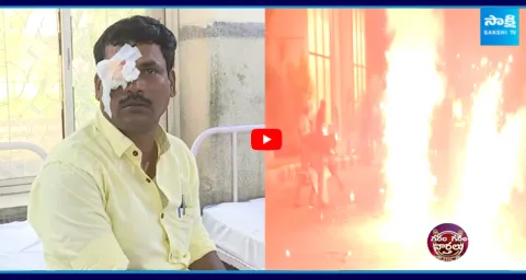 Firecracker eye injuries during Deepavali festival