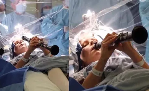 woman with Parkinsons disease plays clarinet during brain surgery
