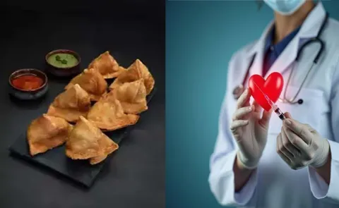 Rs 20 samosa vs Rs 3 lakh angioplasty: Delhi heart doctors blunt warning