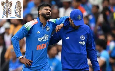 Shreyas Iyer Hospitalised in Australia: What Is a Rib Cage Injury