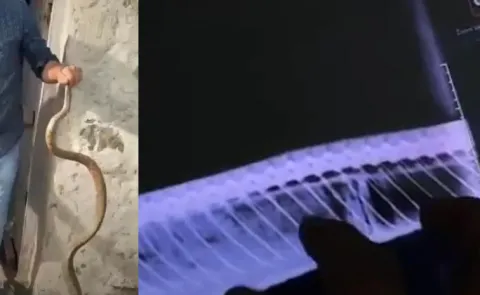 karnataka chitradurga Snake Swallow Plastic Bottle Details Here