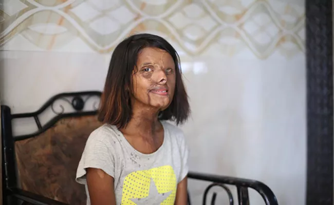 Mumbai acid attack survivor’s heart-touching story - Sakshi