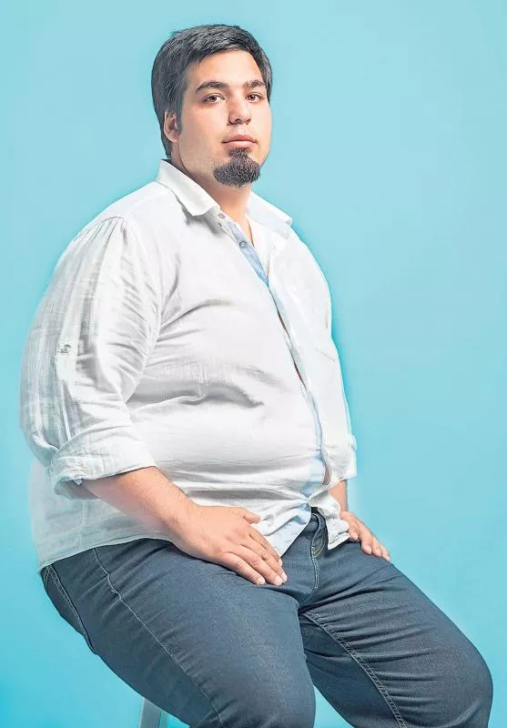 A gene that causes obesity has been identified - Sakshi