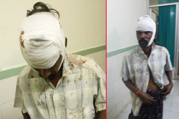 TDP supporters attacked ysrcp activists - Sakshi