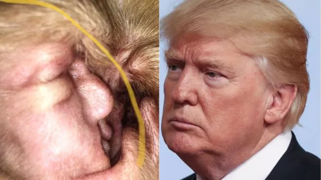 Chief's Ill Ear Look Like Trump face - Sakshi