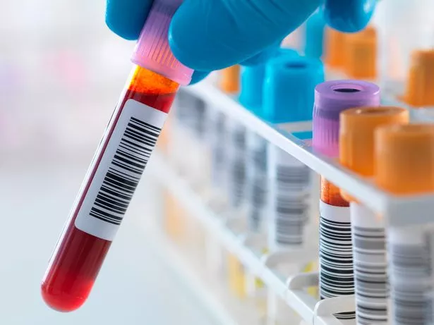 Scientists one step closer to a 'Holy Grail' blood test - Sakshi