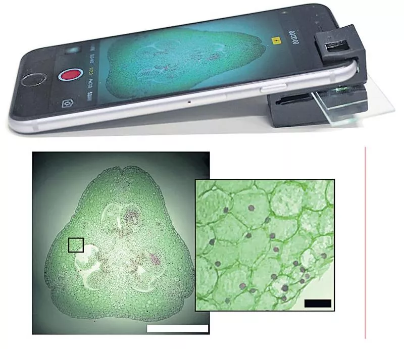 Smartphone camera microscopic gadget - Sakshi