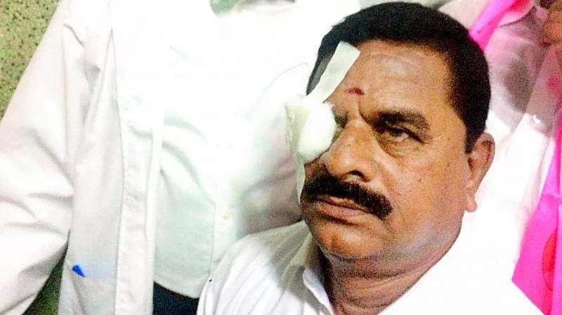 Swamy Goud faking injury to eye? - Sakshi