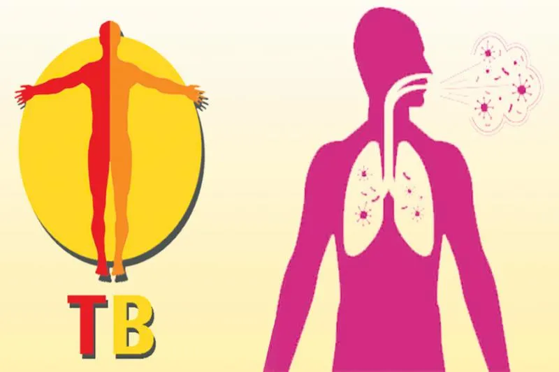 Every year 2,500 people die with Tuberculosis - Sakshi