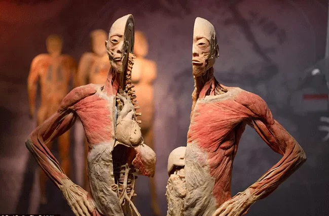 Real Bodies Exhibition In Sydney - Sakshi