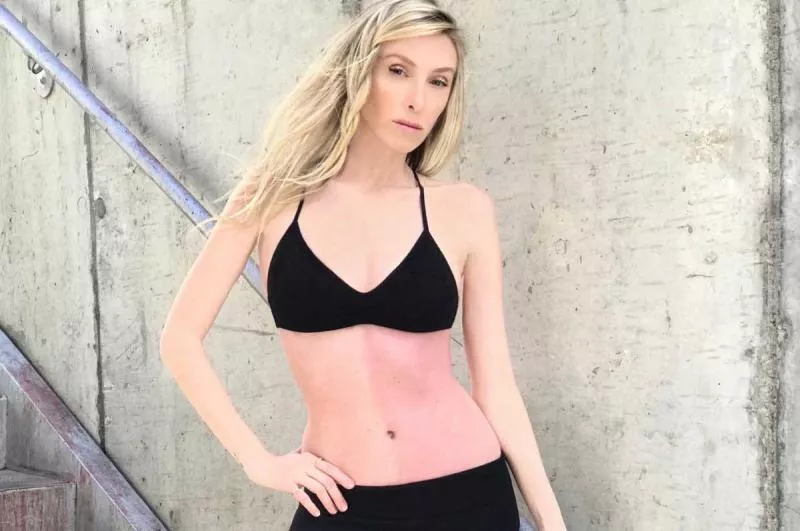 California Model Have BI Colored Stomach Due To Two Sets Of DNA Mixing - Sakshi