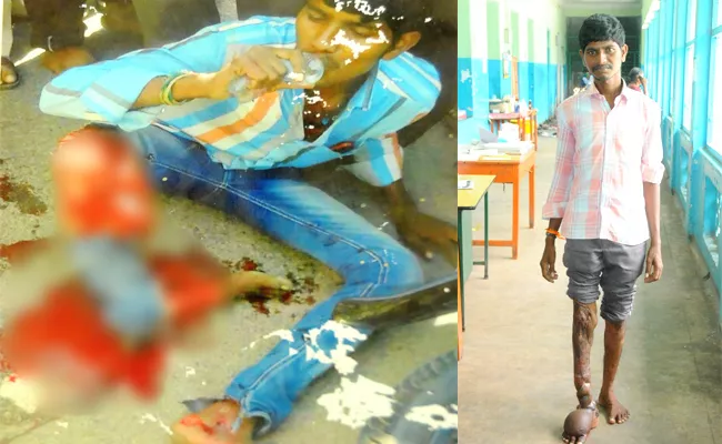 Leg Injured Patient Cured in Kurnool Government Hospital - Sakshi