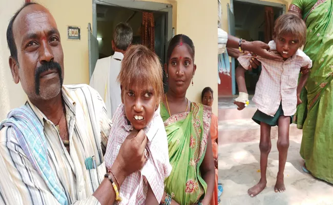 Boy Suffering Hormone Disease In YSR Kadapa - Sakshi