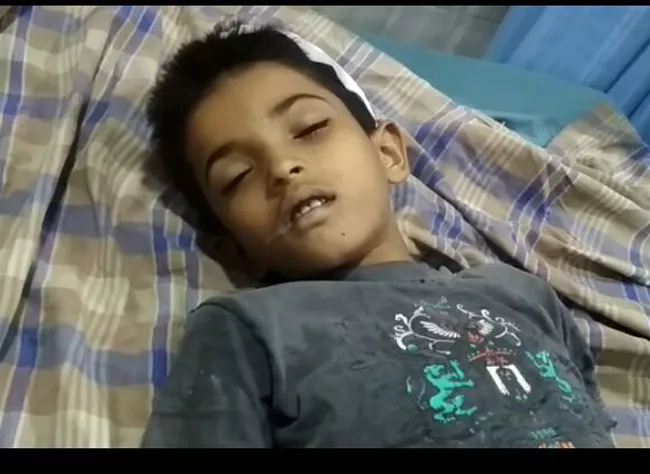 Thunder Bolt Fell On Boy In Hyderabad - Sakshi