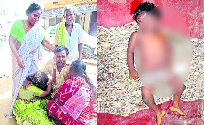 dogs attack on kakinada boy:six years old boy died - Sakshi