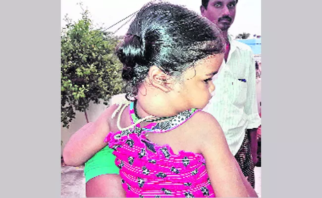 Child Suffering With Tumer In PSR Nellore - Sakshi