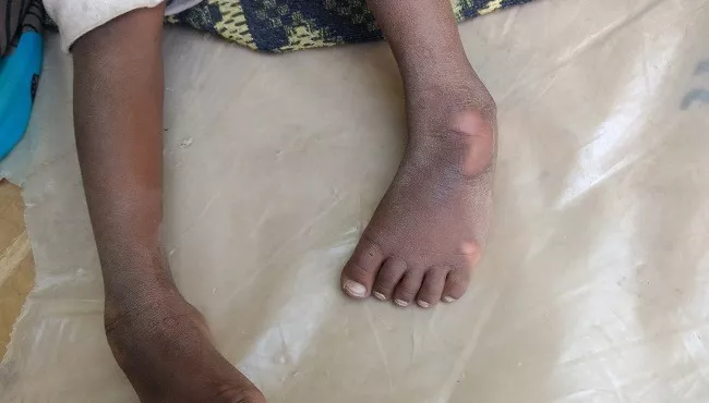 Husband Legs And Hands Broken By His Wife In East Godavari - Sakshi