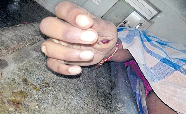 MGM Warangal Rat Bites Off Dead Body - Sakshi