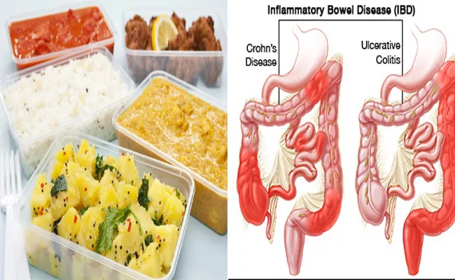 Eating Food In Plastic Goods Cause Inflammatory Bowel Disease - Sakshi