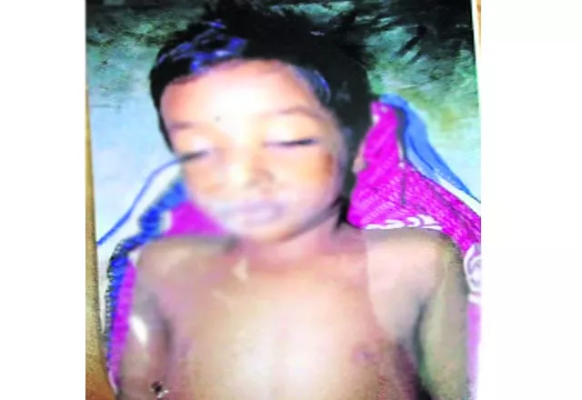 Boy Died By Poison - Sakshi