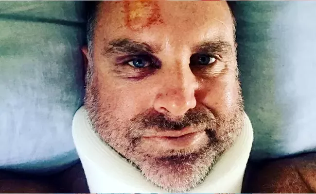 Matthew Hayden Suffers Head Injury - Sakshi