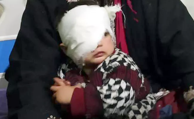 Shopian Girl Hit In Eye By Pellet, Might Lose Sight - Sakshi