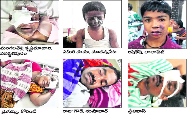 People Injured While Celebrate Deepawali Festival - Sakshi