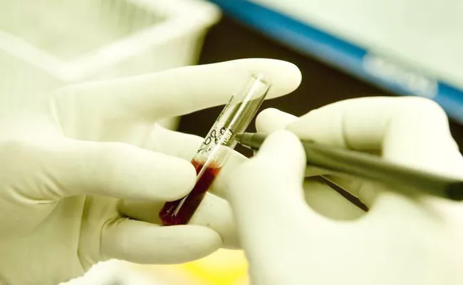 Pregnant Woman Contracts HIV After Blood Transfusion In Tamil Nadu - Sakshi