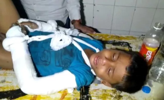 Missing Boy Found With Full Of Injuries At Dabirpura - Sakshi