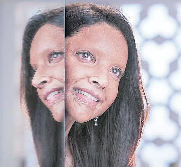 Deepika Padukone as acid attack survivor Laxmi Agarwal in Chhapaak - Sakshi