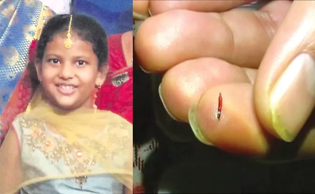 Student Eye Injured Pencil Fight in School Hyderabad - Sakshi