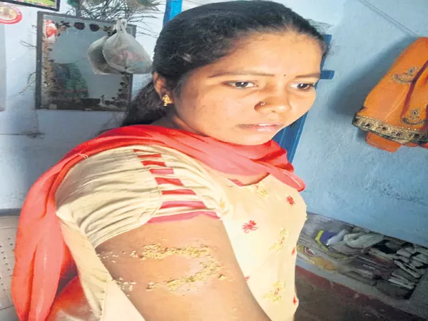 Dog Attack On Women At Patan Cheru - Sakshi